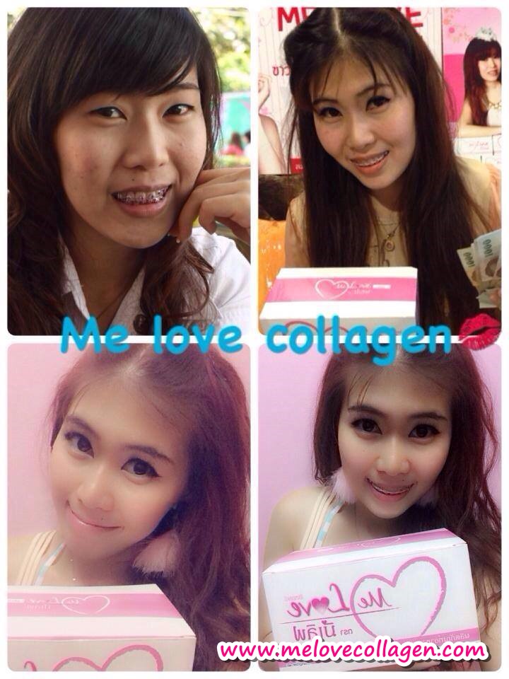 มีเลิฟ ราคาถูก รีวิว