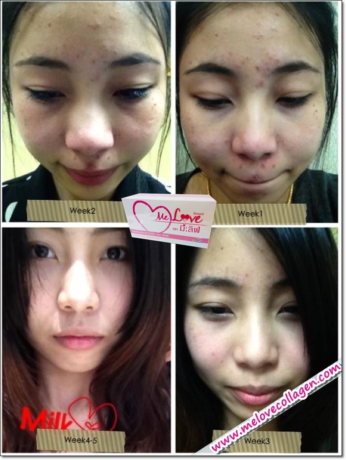melove มีเลิฟ