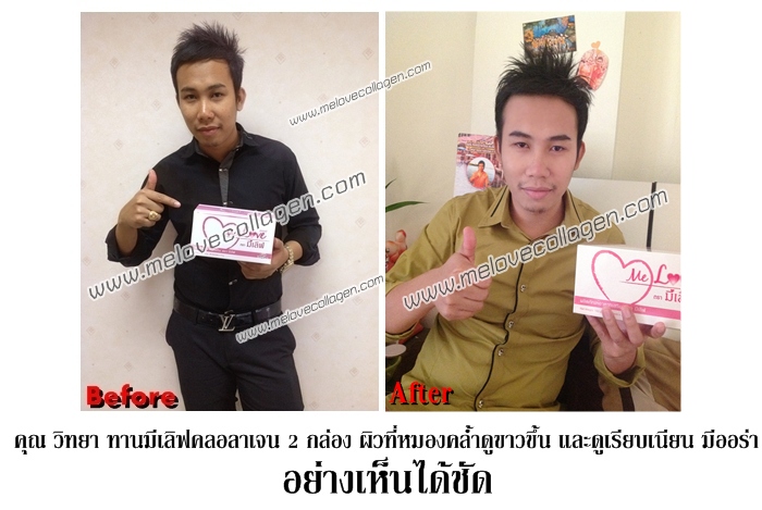 มีเลิฟคอลลาเจน melovecollagen คอลลาเจนผิวขาวเห็นผลไวใน7วัน www.melovecollagen.com