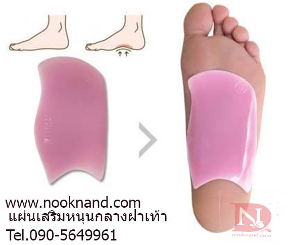แผ่นรองอุ้งเท้าสำหรับผู้ที่มีอาการเท้าแบนหรือเป็นรองช้ำ