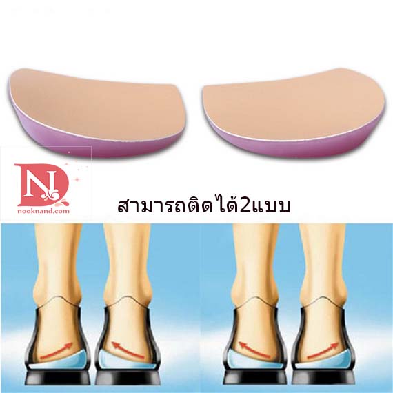 แผ่นรองส้นเท้าสำหรับผู้ที่เดินขาโก่งเป็นรูปตัวX/O