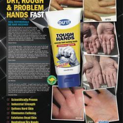 DU'IT Tough Hands Intensive Skin Repair Cream 150ml. นำเข้าจาก Australia ครีมบำรุงผิวมือที่แห้งด้านขาดความชุ่มชื่น อีกหนึ่งผลิตภัณฑ์ที่ขายดีของแบรนด์นี้คะ แค่ทาวันละ2-3 ครั้งต่อวัน เพียง 5 วัน ผิวมือก็จะเนียนนุ่มชุ่มชื่นขึ้นอย่างเห็นได้ชั
